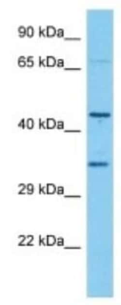 Olfactory receptor 490 Rabbit anti-Mouse, Polyclonal, Novus Biologicals 100 &mu;g | Buy Online | Novus Biologicals | Fisher Scientific